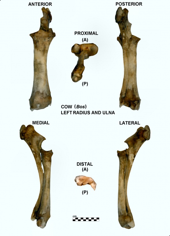 Radius et ulna gauches