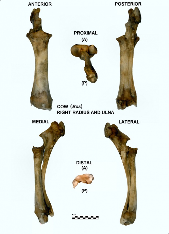 Radius et ulna droits