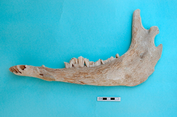 Mandibule : vue médiale