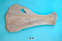 Scapula : vue latérale