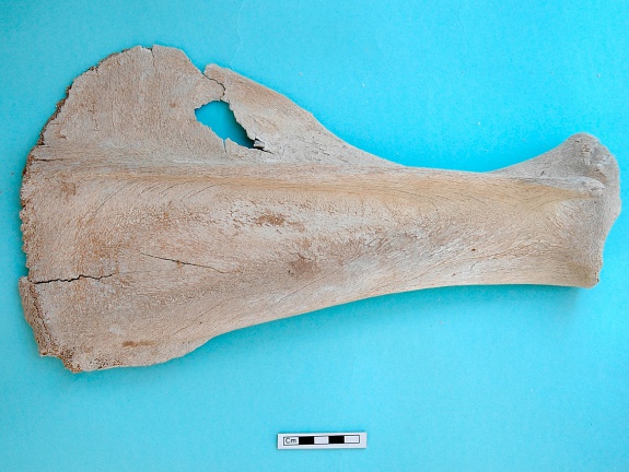 Scapula : vue latérale