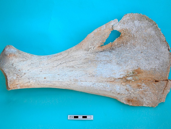 Scapula : vue médiale