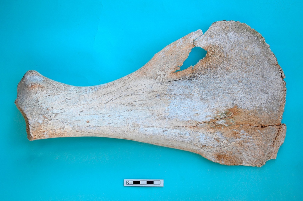 Scapula : vue médiale