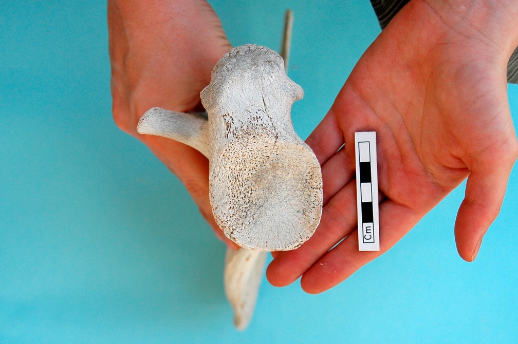 Scapula : vue ventrale