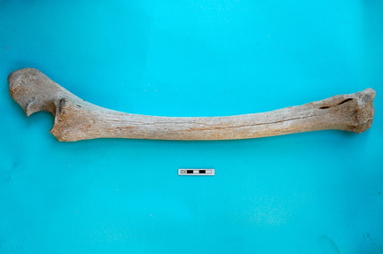  Radio y ulna : vista lateral