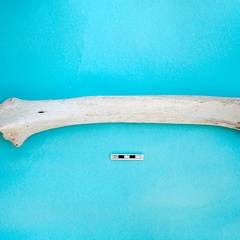  Radius and ulna: posterior view