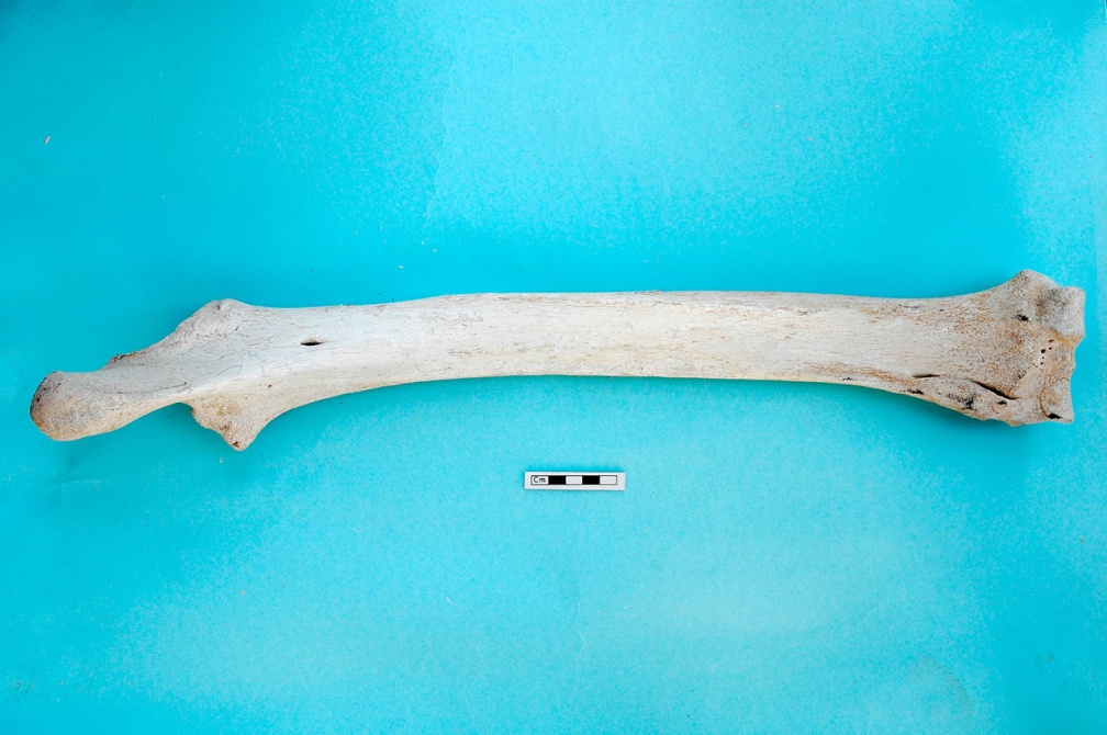  Radio y ulna : vista posterior