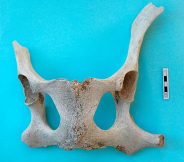 Pelvis : vue dorsale