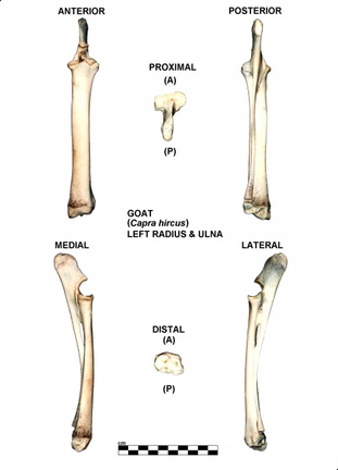 Radius et ulna gauches