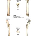 Radius et ulna gauches