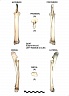 Radius et ulna gauches