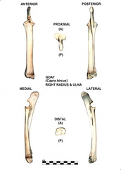 Right radius and ulna