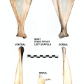 Scapula gauche