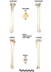 Left tibia