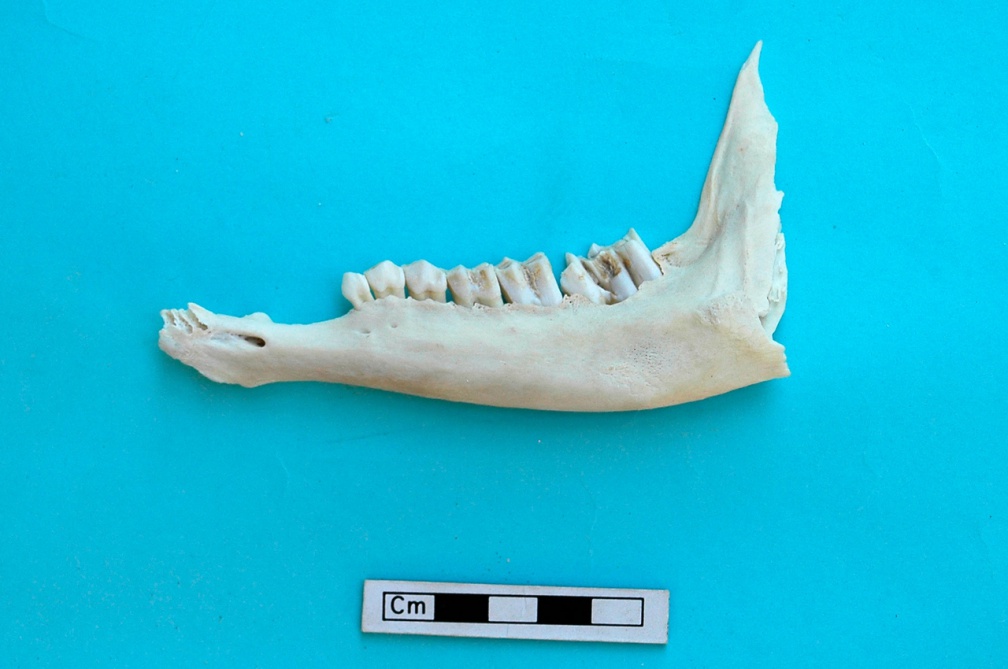 Mandibule : vue latérale