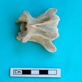 Cervical vertebra