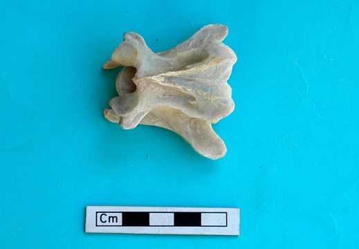 Cervical vertebra