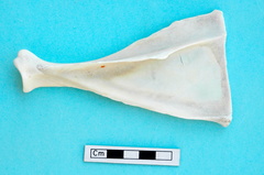 Scapula : vue latérale