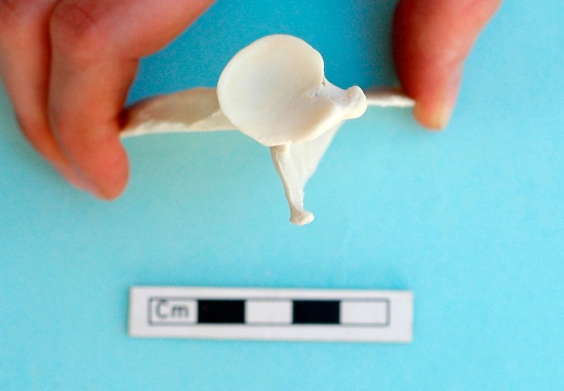 Scapula: ventral view