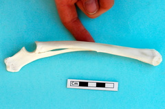  Radius and ulna: medial view