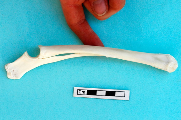 Radius et ulna : vue médiale