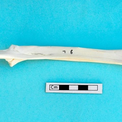  Radius and ulna: posterior view