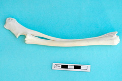  Radius and ulna: side view