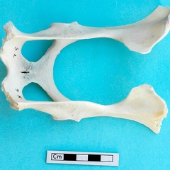 Pelvis: dorsal view