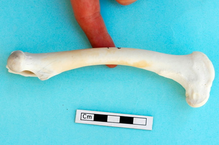 Femur: medial view