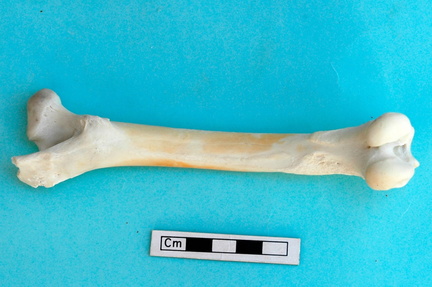 Femur: posterior view