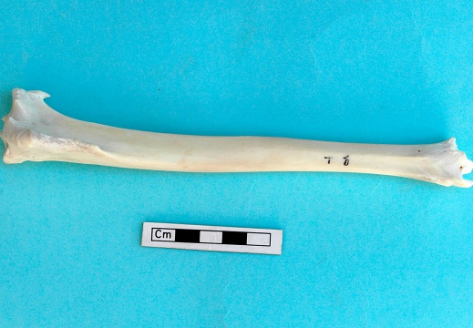 Tibia : vista anterior