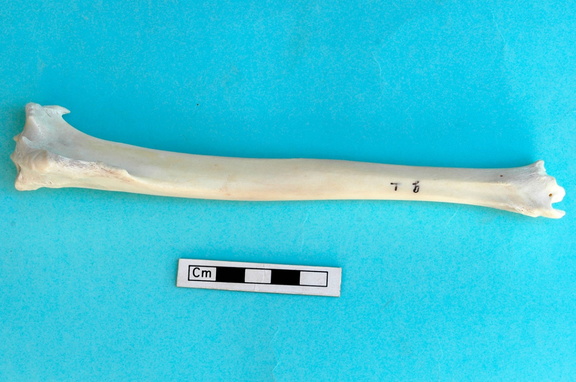 Tibia : vue antérieure
