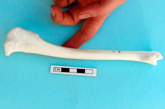 Tibia : vue médiale