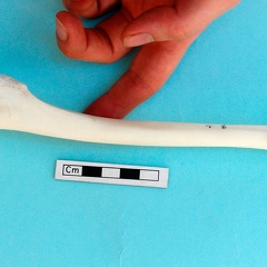 Tibia: medial view