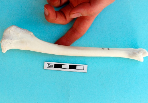 Tibia: medial view