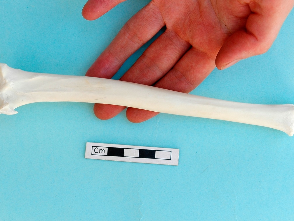 Tibia : vista posterior