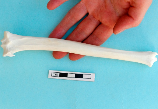 Tibia: posterior view