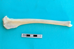 Tibia: vue latérale