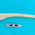 Tibia: vue latérale