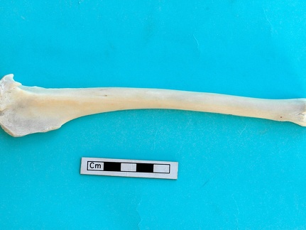 Tibia: side view
