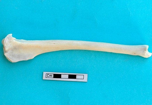 Tibia: vue latérale