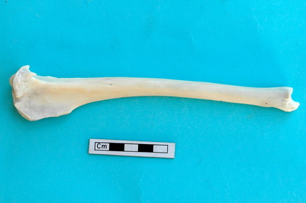 Tibia: side view