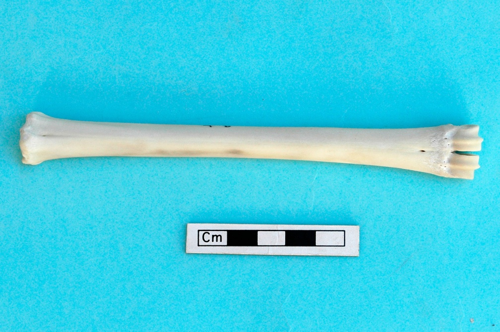 Métacarpe : vue antérieure