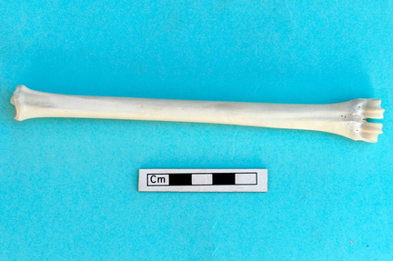 Metatarsus: anterior view