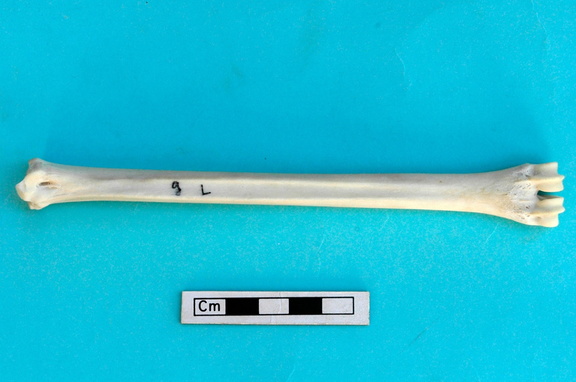 Métatarse : vue postérieure