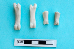 Phalanges