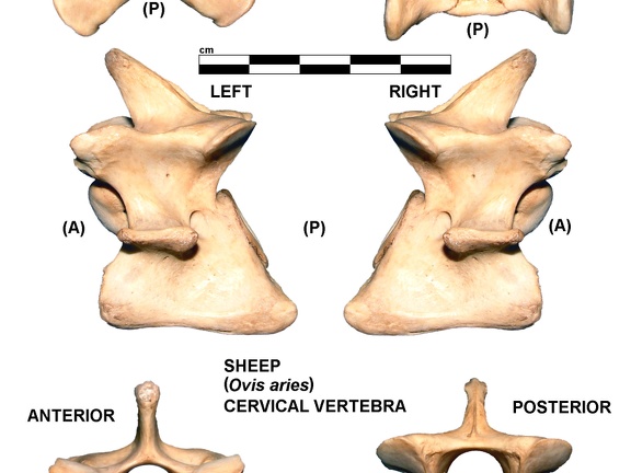 Vértebra cervicale