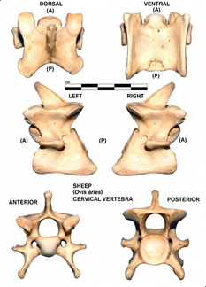 Vertèbre cervicale