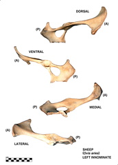 Coxal gauche