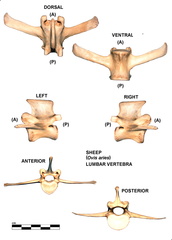 Lumbar vertebra